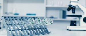 Prostatabiopsie-Alternativen